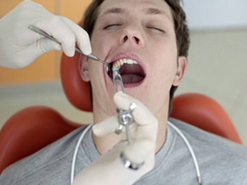 Quy trình điều trị răng khôn