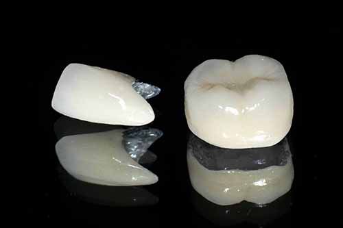 Độ bền của răng sứ thẩm mỹ