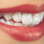 Làm răng sứ ở đâu tốt và uy tín nhất?