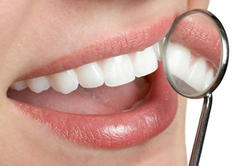 Có nên lấy cao răng thường xuyên không?